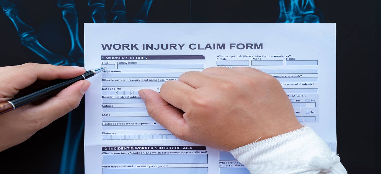 The Difference Between Workers’ Compensation and FELA in Work-Related Injury Claims